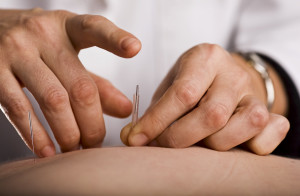 Tapping in acupuncture needle